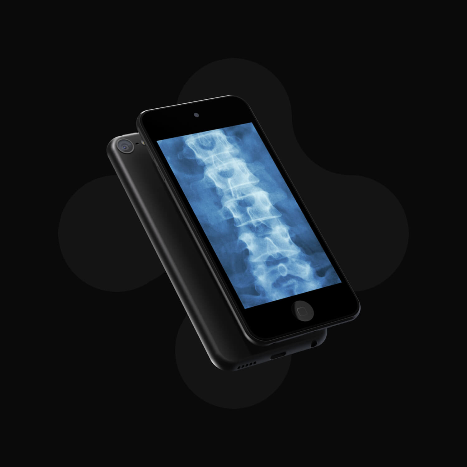 4th generation ipod touch displaying an x-ray image of a spine